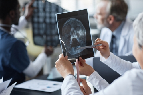 A medical professional holding an X-ray image of a skull, analyzing it during a team consultation in a hospital setting